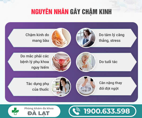 Hình ảnh minh họa